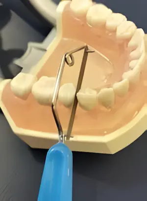 歯の間を削るディスキング