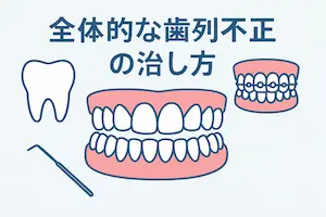 全体的な歯列不正の治し方 2 全体的な歯列不正の治し方