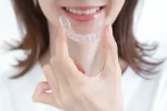 歯を白くするならまずホワイトニング(歯の漂白) 4 ホワイトニング用マウスピース