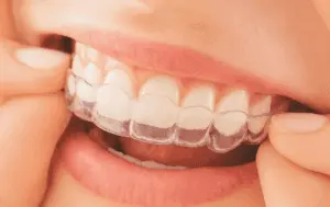 保定用マウスピース