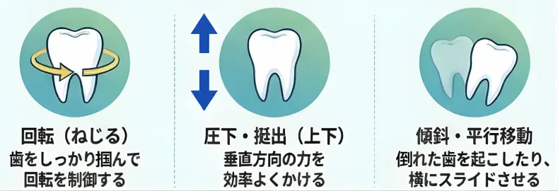 How attachments move teeth