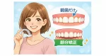 前歯だけ矯正 マウスピース 部分矯正のイメージ