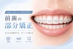 前歯の部分矯正——筆者が診てきた症例と、適応の判断基準 8 前歯の部分矯正