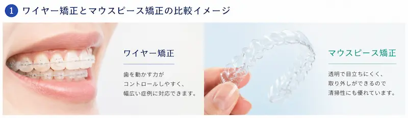 マウスピース矯正とワイヤー矯正