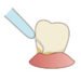歯根表面を滑沢にするルートプレーニングという処置のイラストです（アイキャッチ画像）。