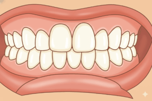 矯正治療後のきれいな歯列