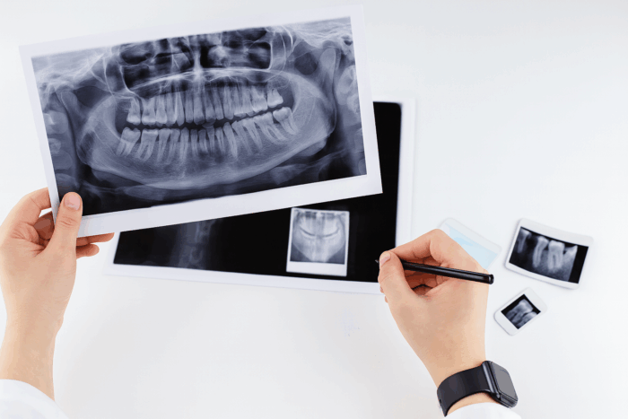 パノラマレントゲン検査