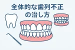 全体的な歯列不正の治し方
