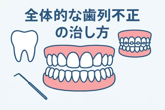 全体的な歯列不正の治し方