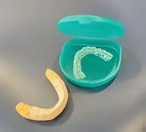 ホワイトニングの基本情報