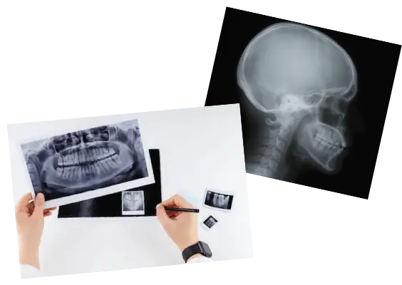 レントゲン検査